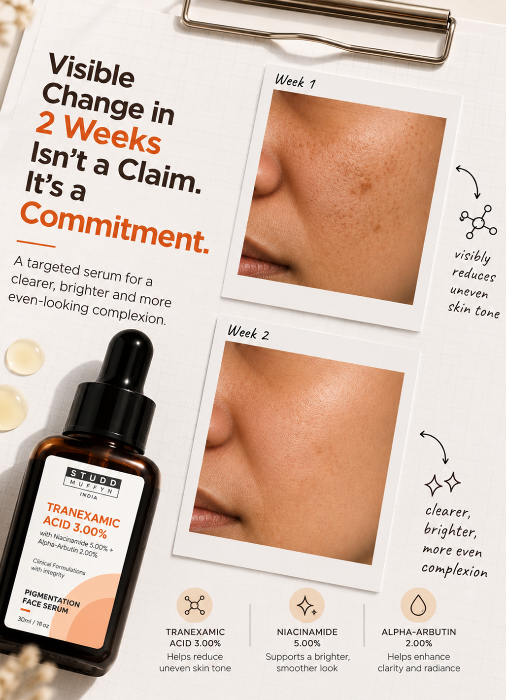 Tranexamic Acid 3% Pigmentation Face Serum (30ml)