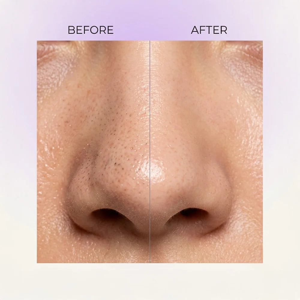 Nose Serum