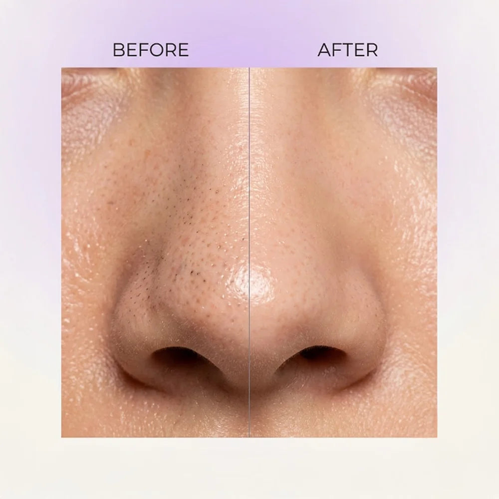 Nose Peel Off Mask