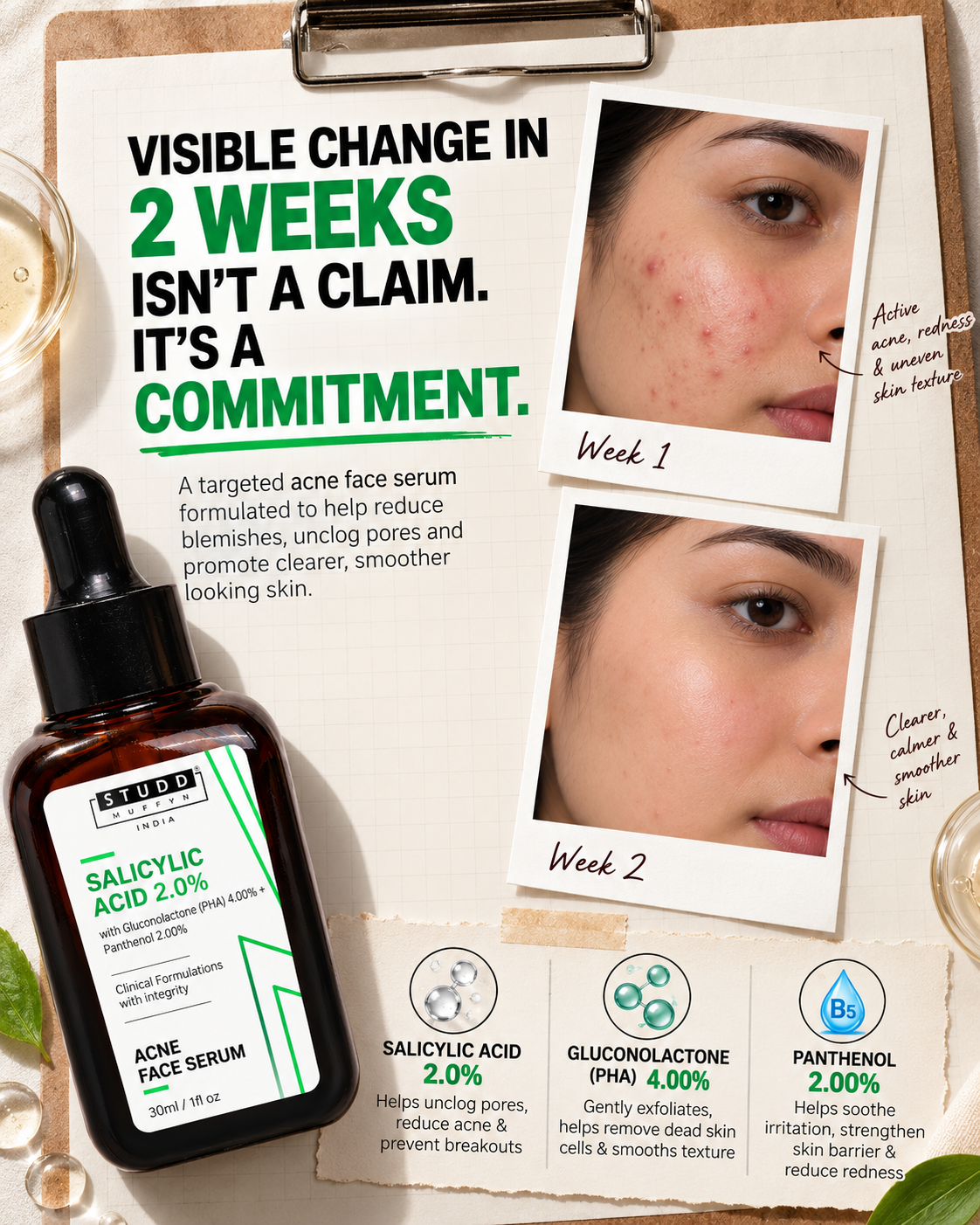 Salicylic Acid 2% Acne Face Serum (30ml)